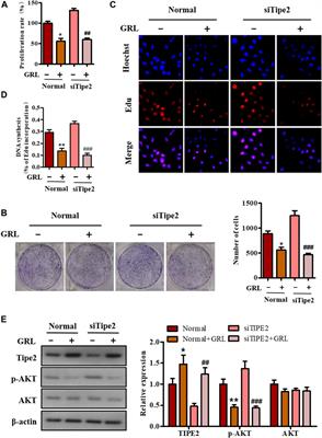 Beneficial Effects of Gracillin From Rhizoma Paridis Against Gastric Carcinoma via the Potential TIPE2-Mediated Induction of Endogenous Apoptosis and Inhibition of Migration in BGC823 Cells